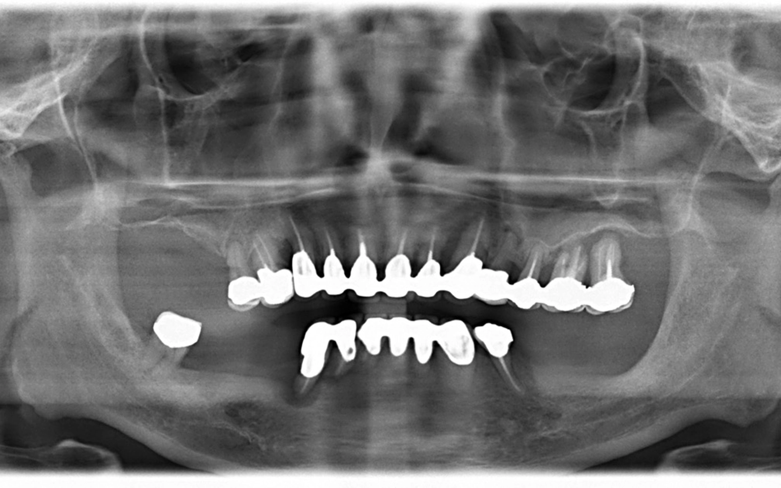 初診時におけるレントゲン写真