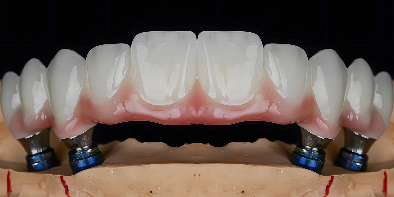 オールオン4のイメージ画像