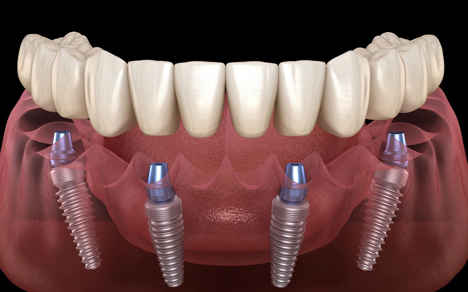 オールオン4のイメージ画像