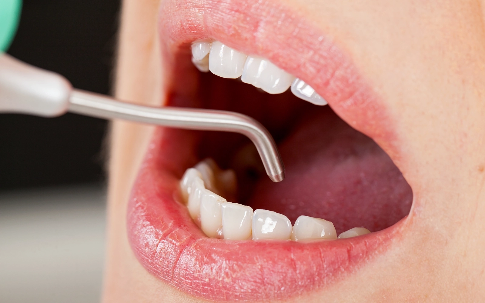 治療後のメンテナンス