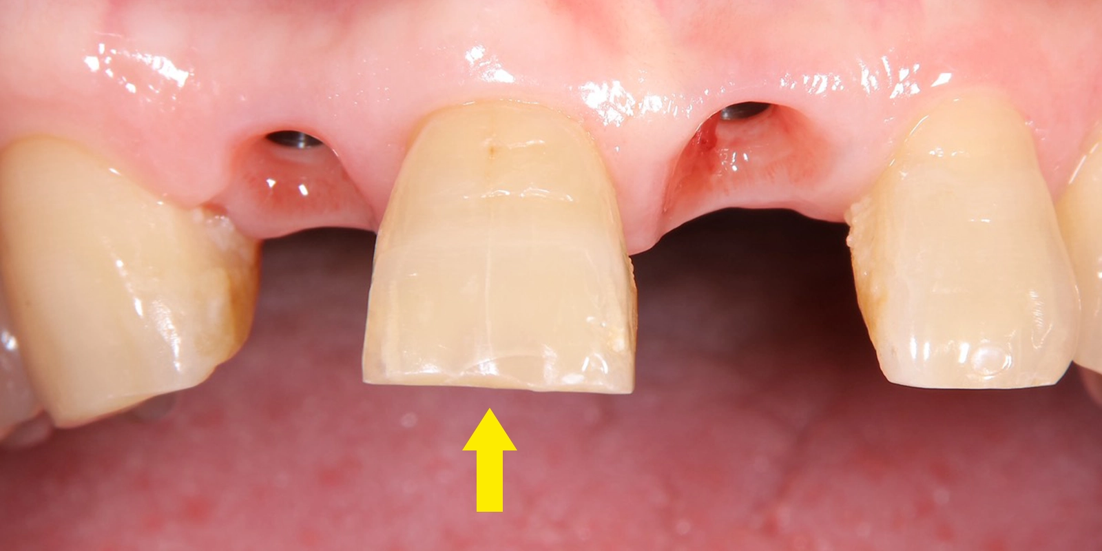 色調合わせの難しさとその対応