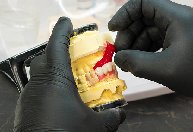 Prosthetic Teeth Treatment 補綴とは?
