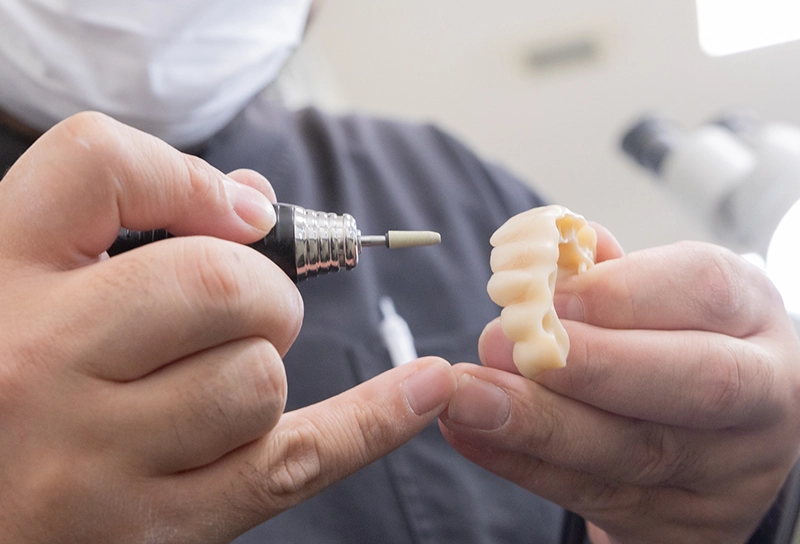 Prosthetic Teeth Treatment 補綴とは?