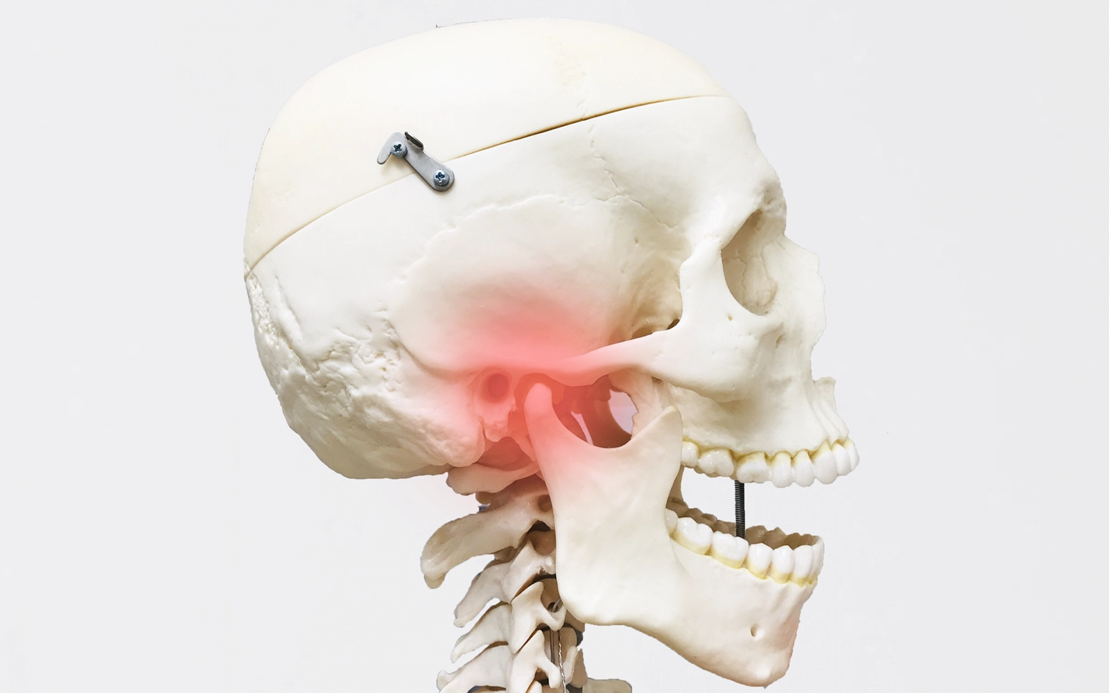 噛み合わせ・顎関節症