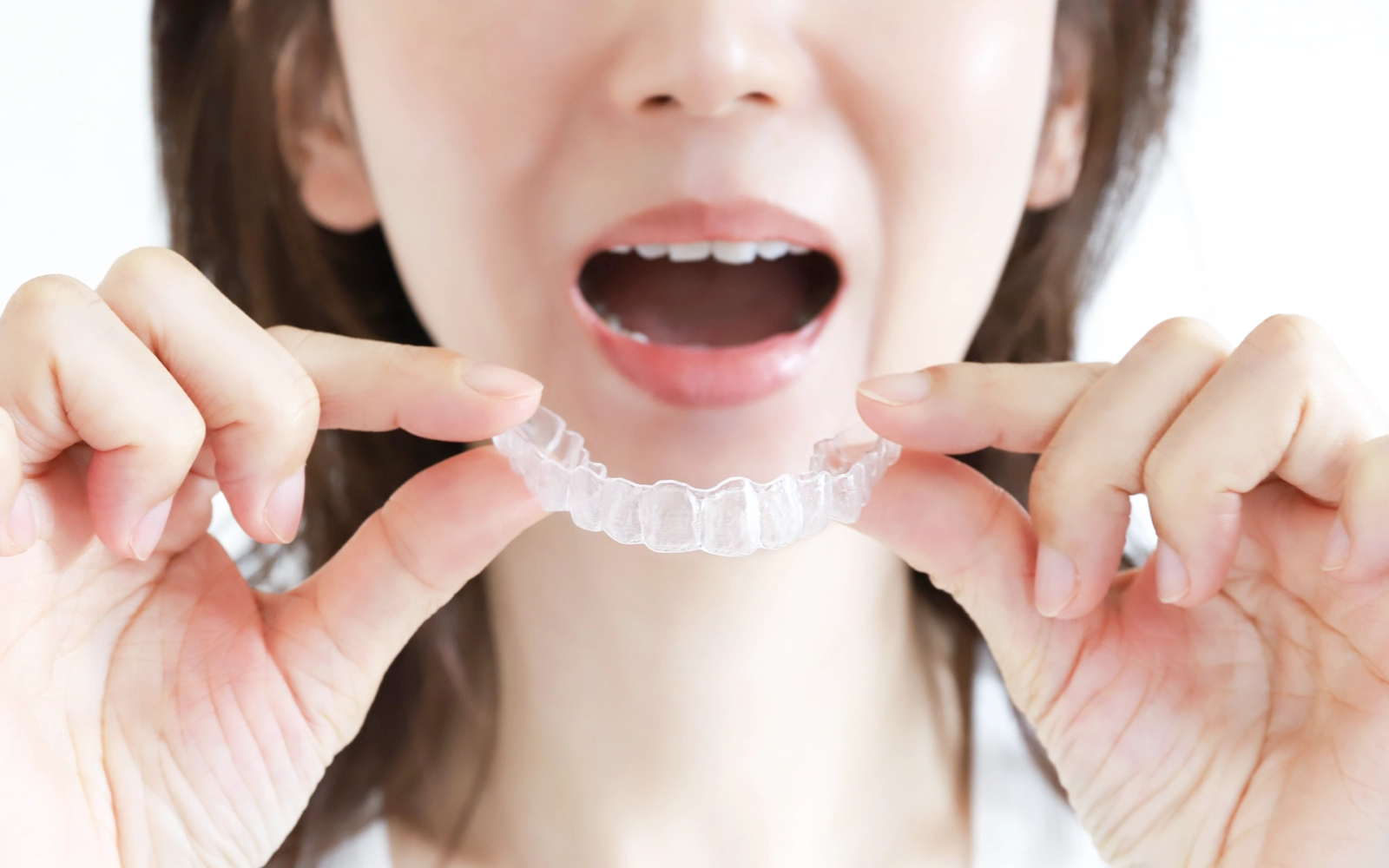 マウスピース（スプリント）療法