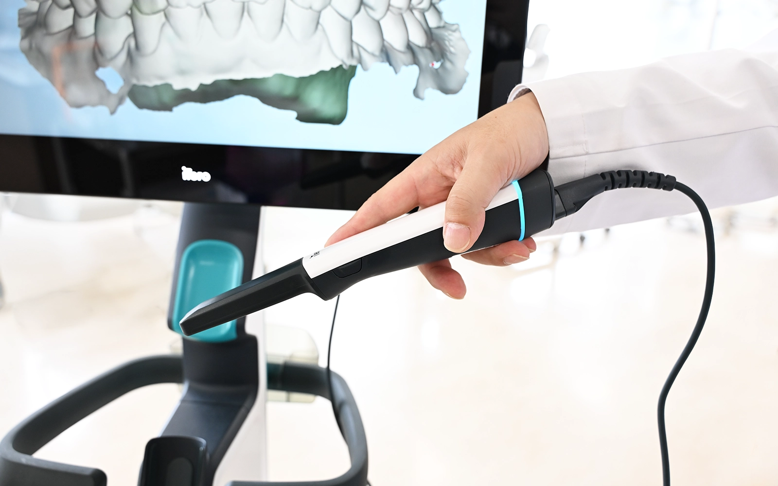 口腔内スキャナーによる精密な型取り