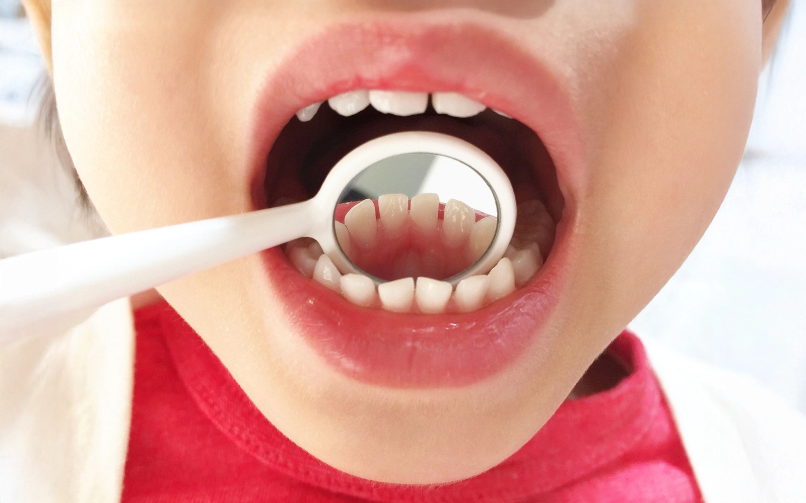 最強のタッグ：小児歯科専門医×矯正専門医の連携