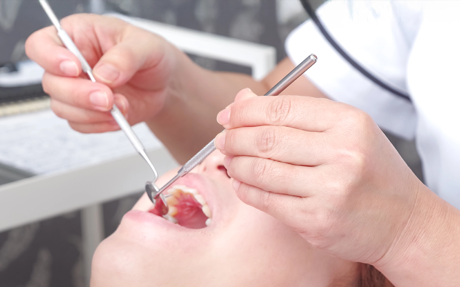 「予防歯科」を見る大切な歯を守る治療