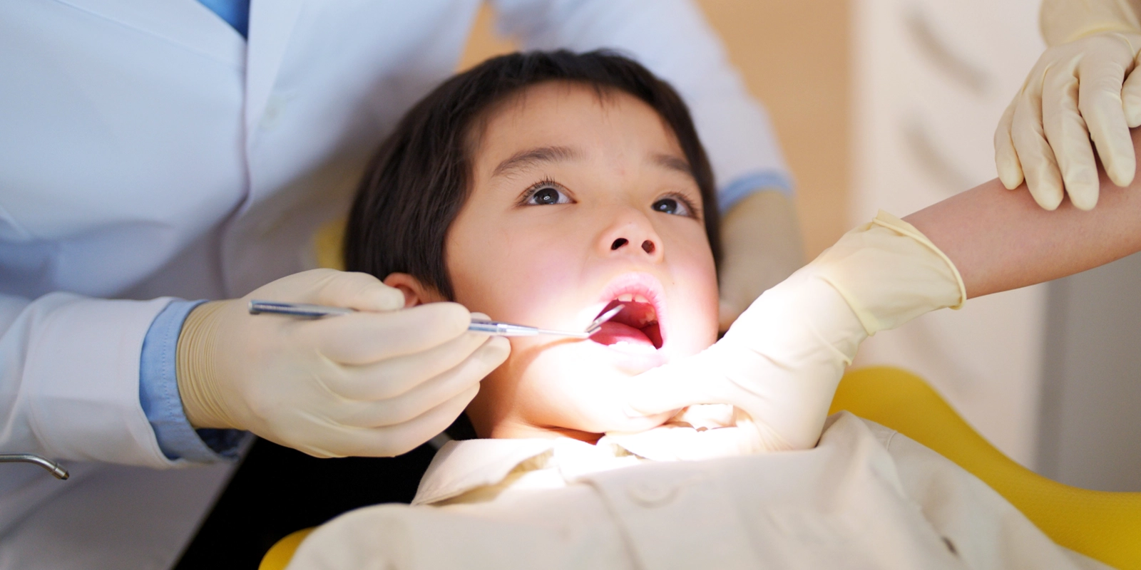 虫歯になってしまった場合の治療方針