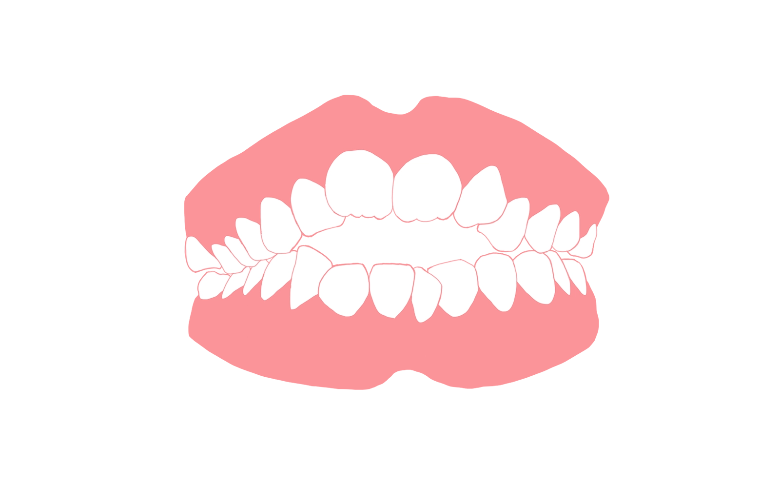 口腔機能の正常化