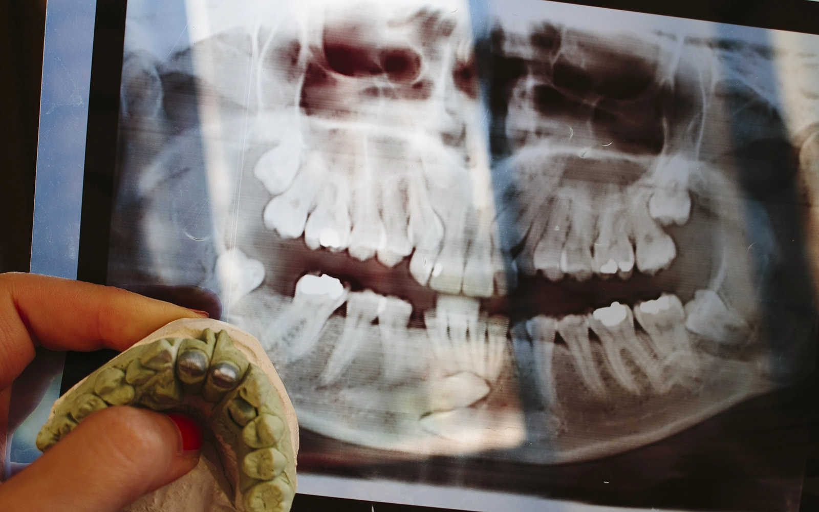 治療過程の記録と可視化