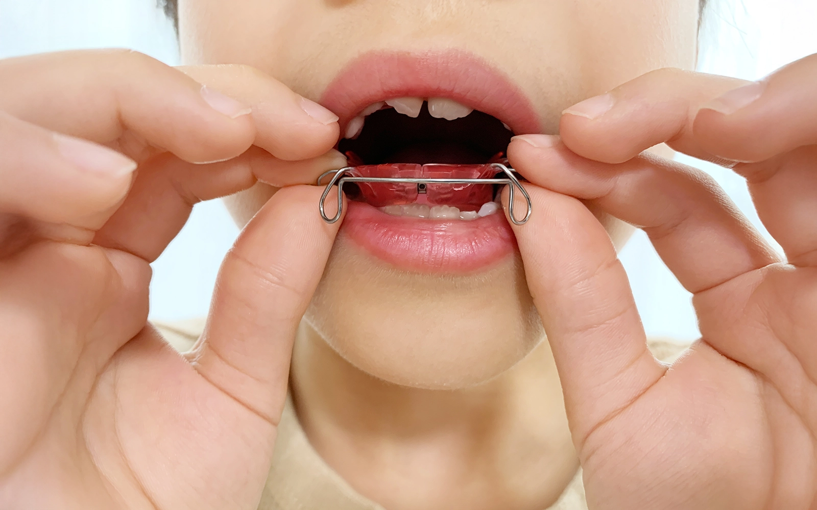 機能的矯正装置