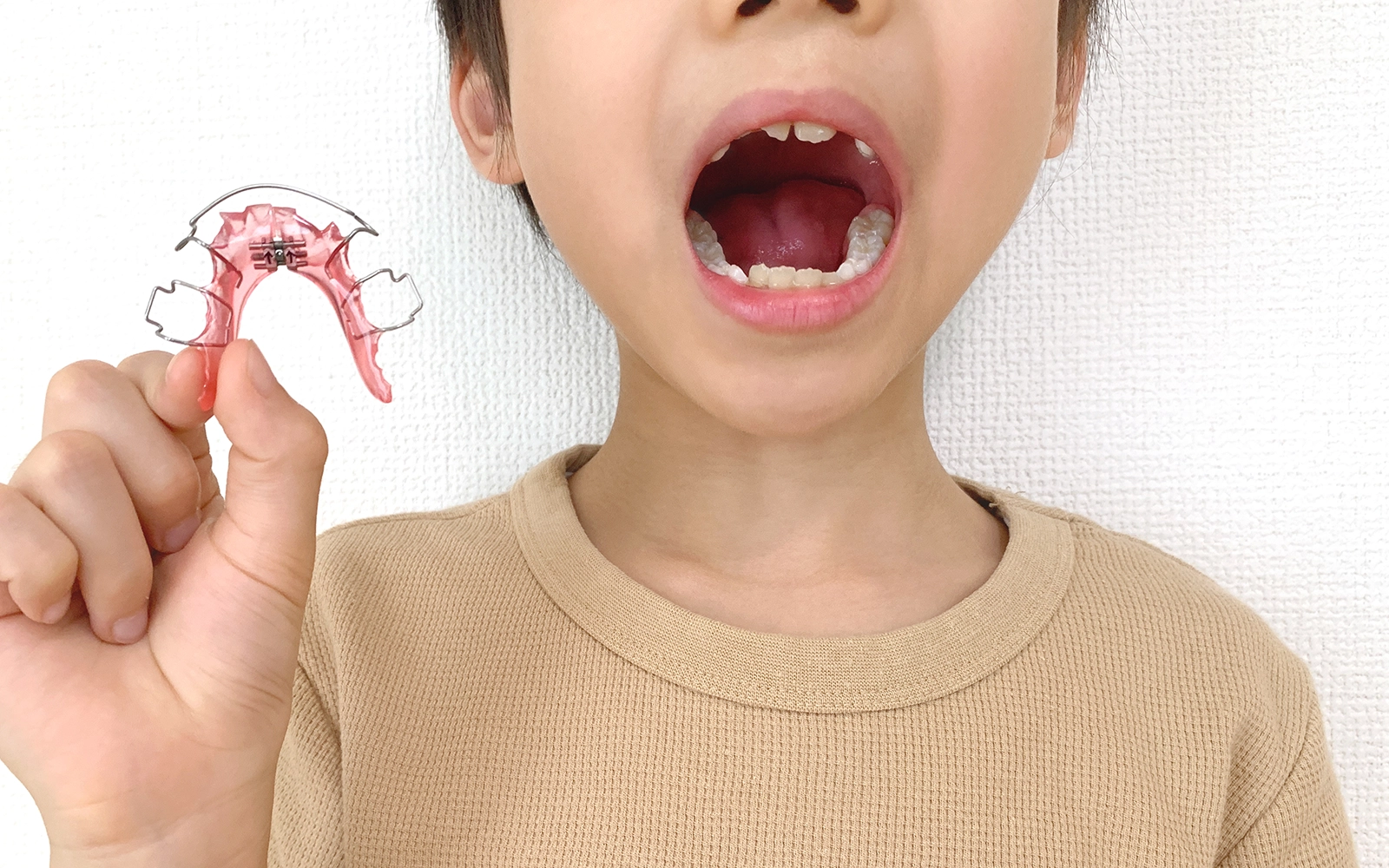 1期治療（小児矯正）の実施