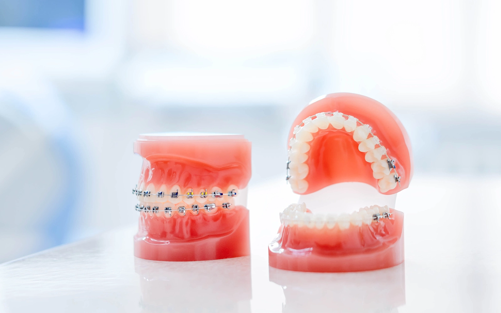 「矯正歯科」を見る正しい噛み合わせを実現