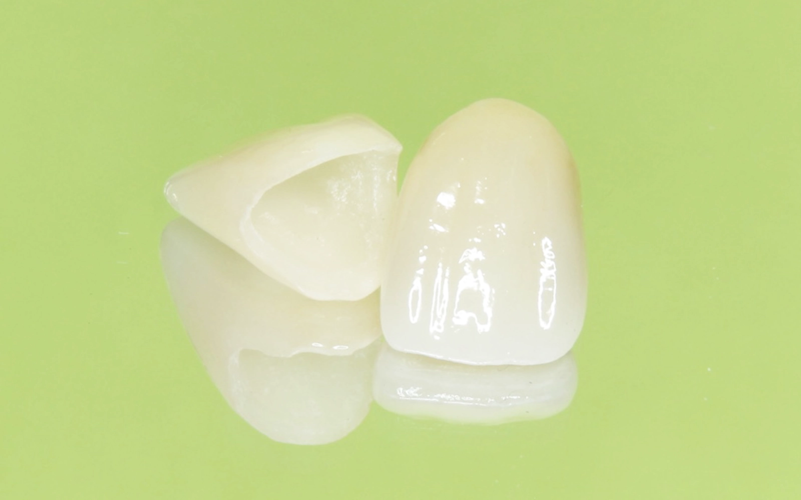 オールセラミッククラウン(被せ物)