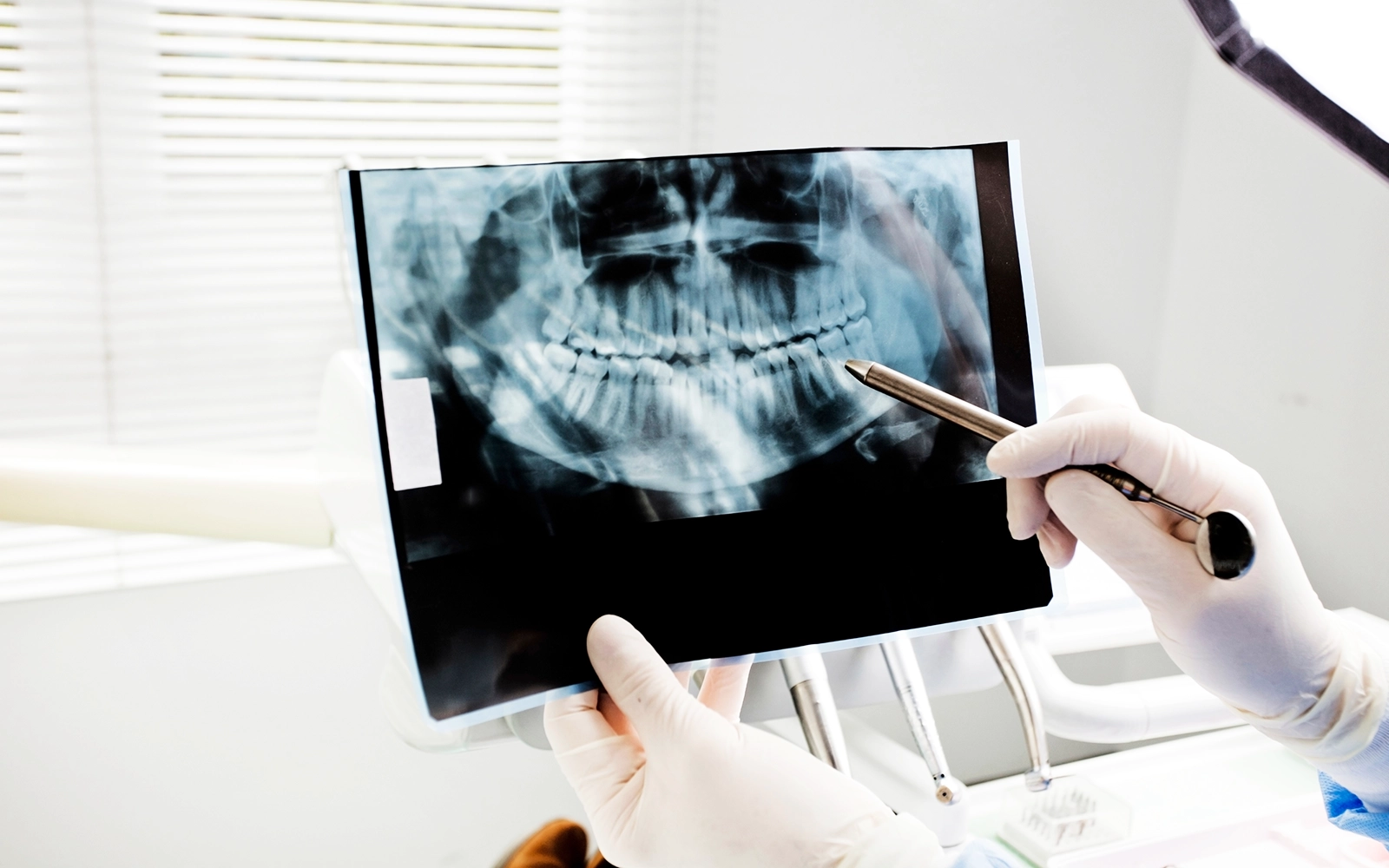 治療過程の記録と可視化