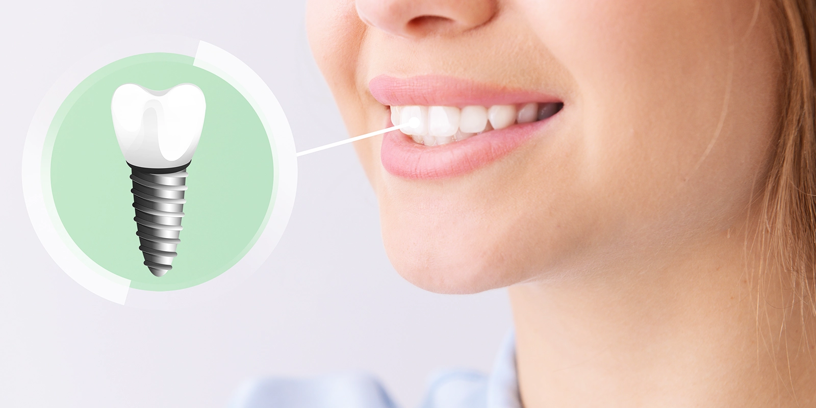 最終形態から逆算する「トップダウン設計」による治療