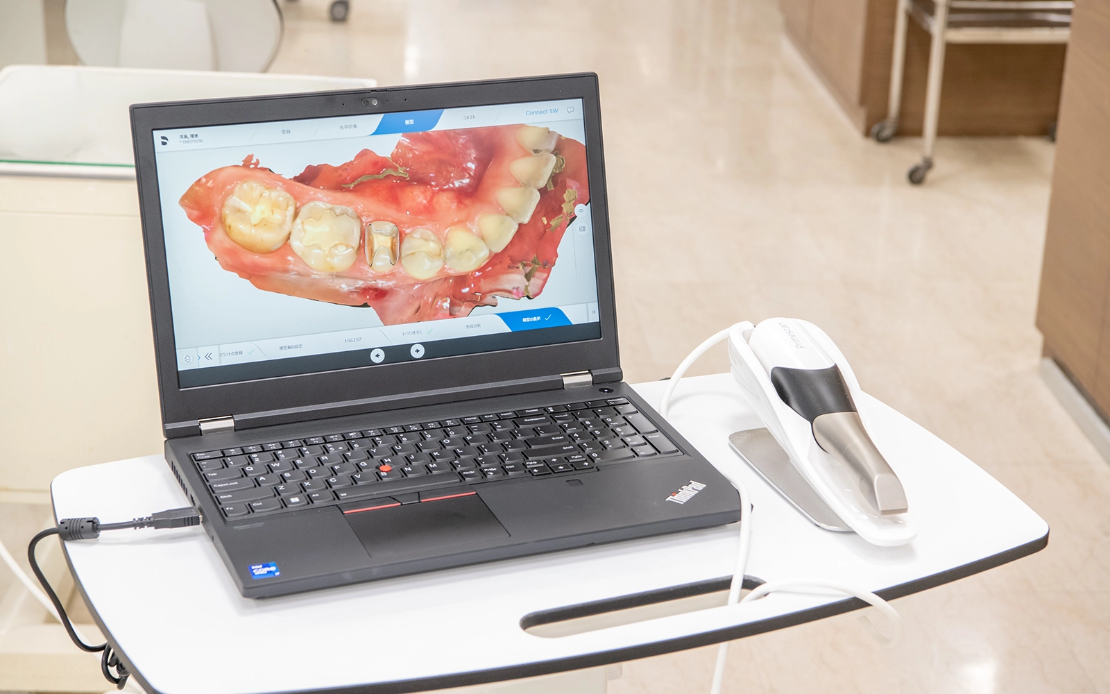 マウスピース矯正の仕組み