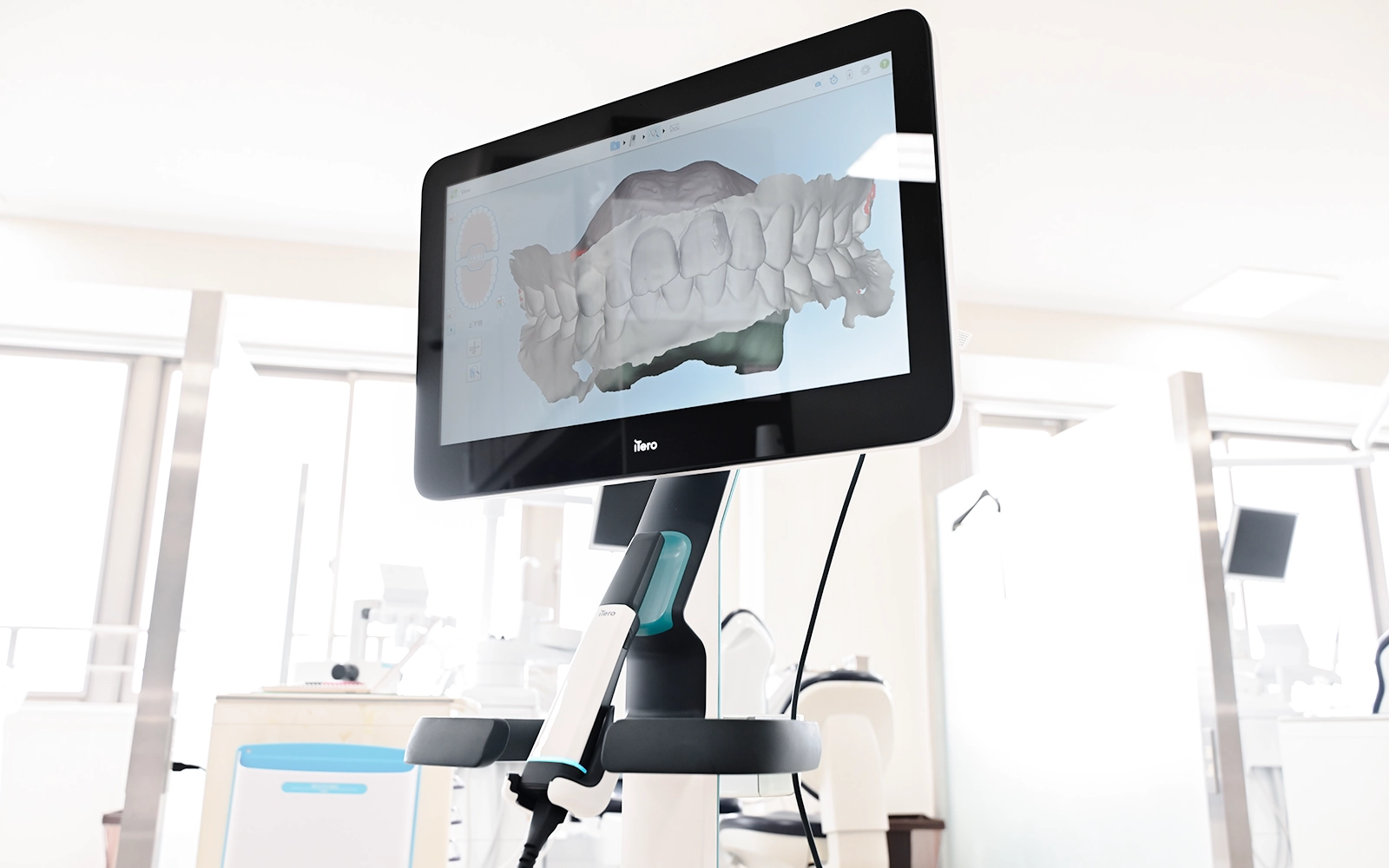 精密検査で使用する口腔内スキャナーについて