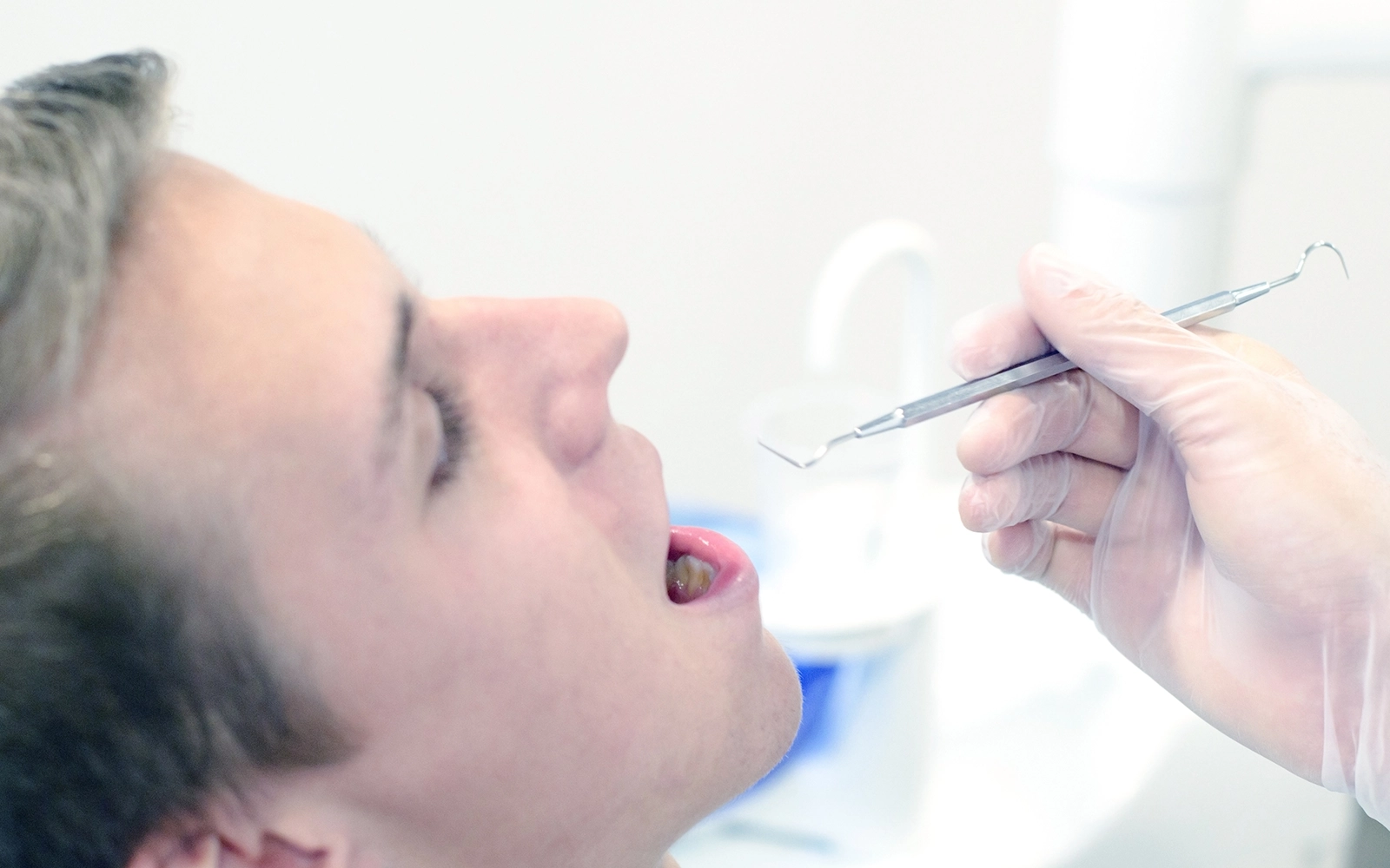 「歯周外科治療」を見る改善が困難な重度歯周病にも対応