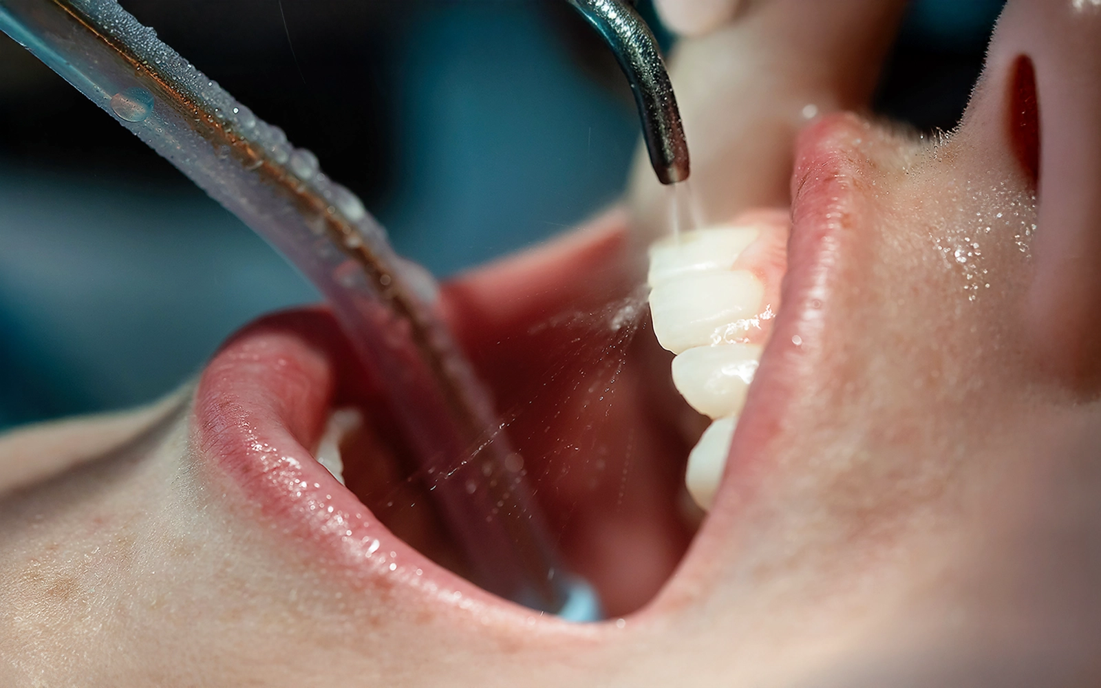 治療後のメンテナンスと再発防止