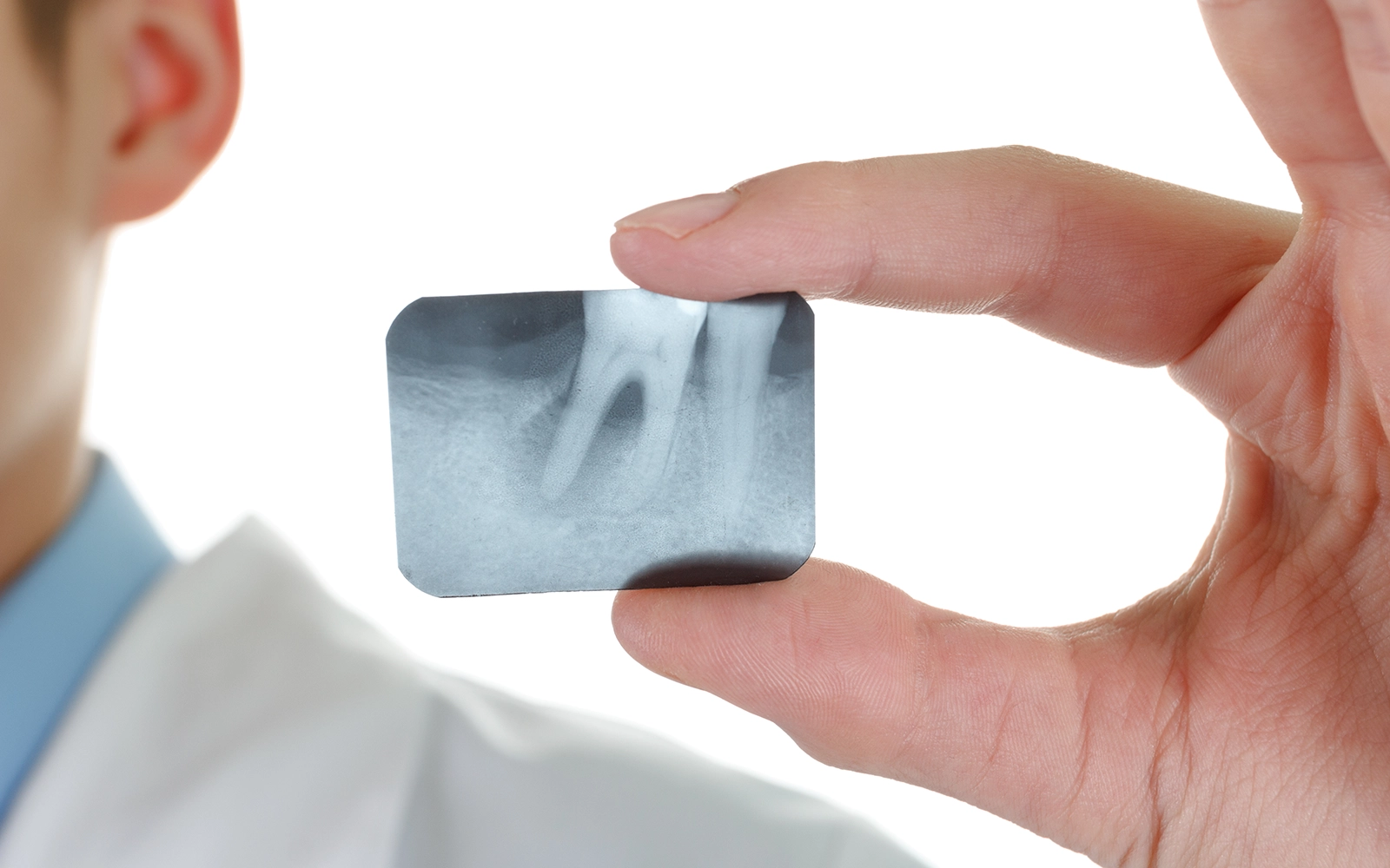 「歯周病治療」を見る全身疾患にも深く関わる治療