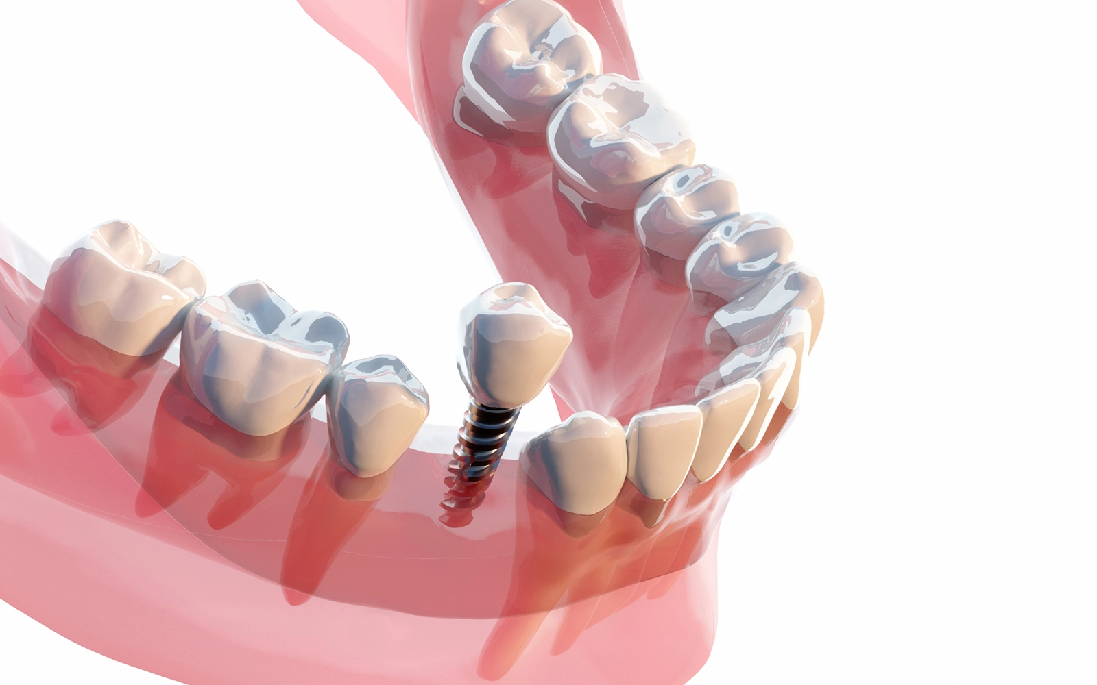 パウダークリーニング