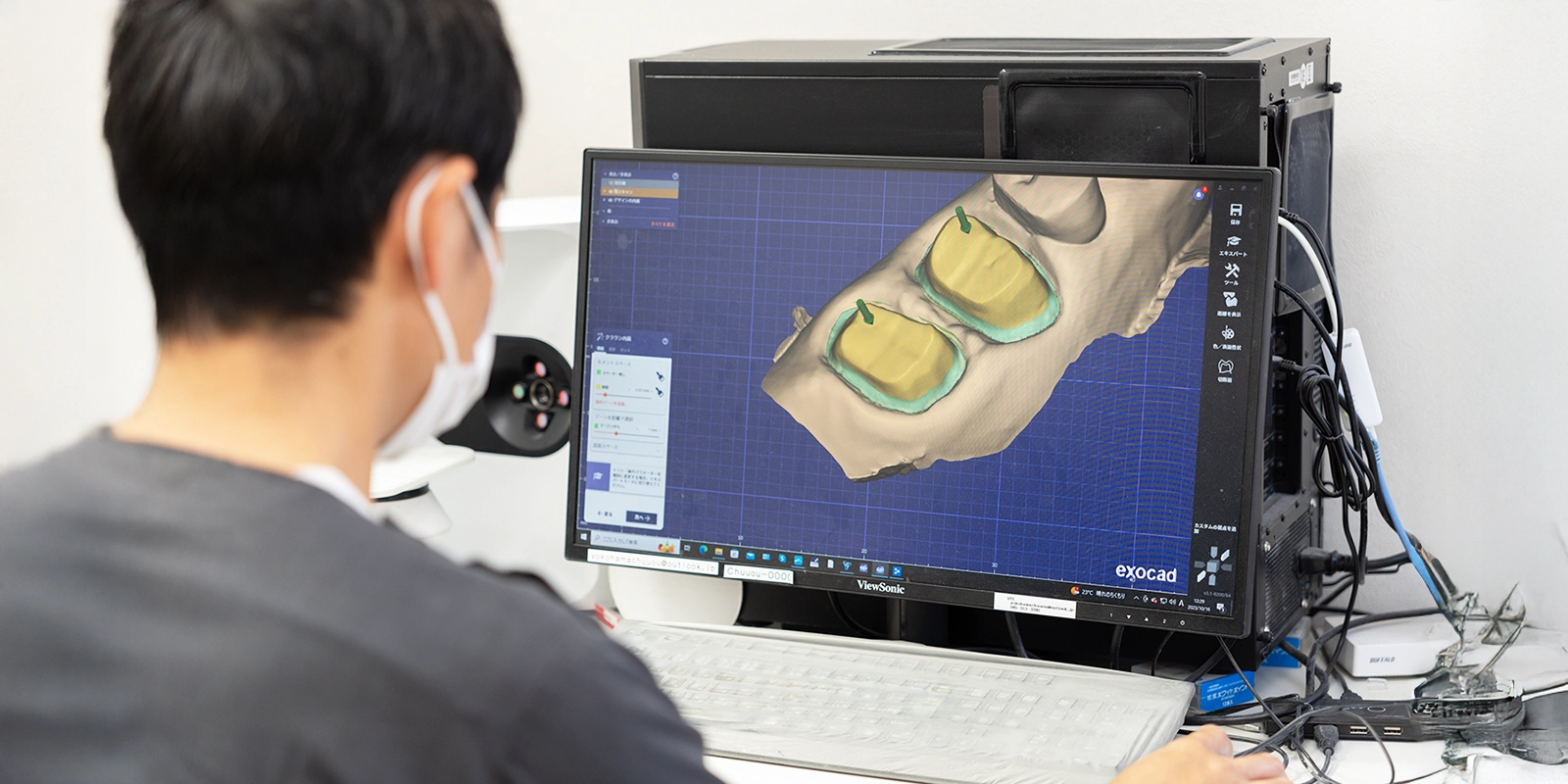院内に技工所を併設。院内技工がもたらす圧倒的な優位性
