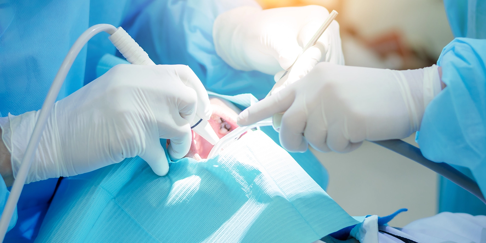 口腔外科とは何か