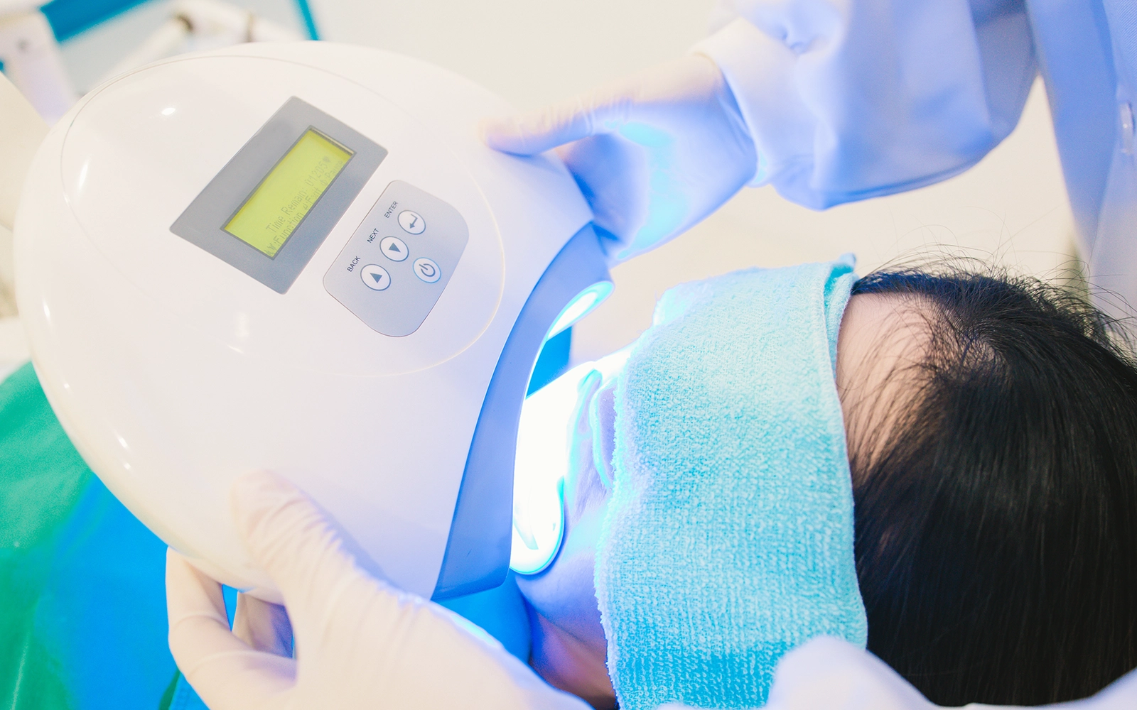 オフィスホワイトニング(即効性重視)