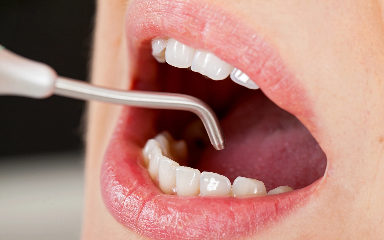 「予防歯科」を見る大切な歯を守る治療