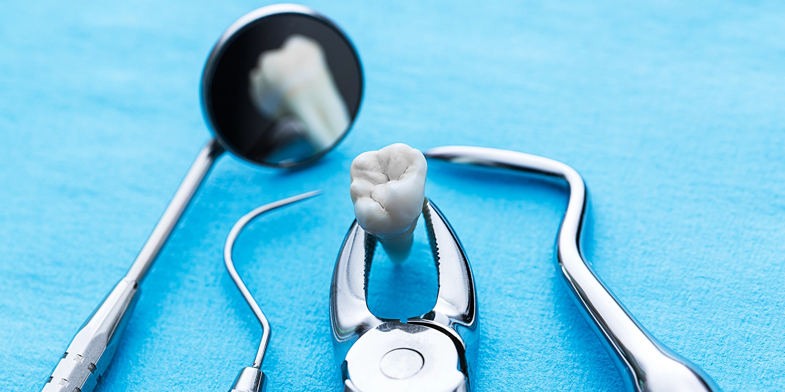 親知らずとは何か、そしてなぜ問題が起きるのか