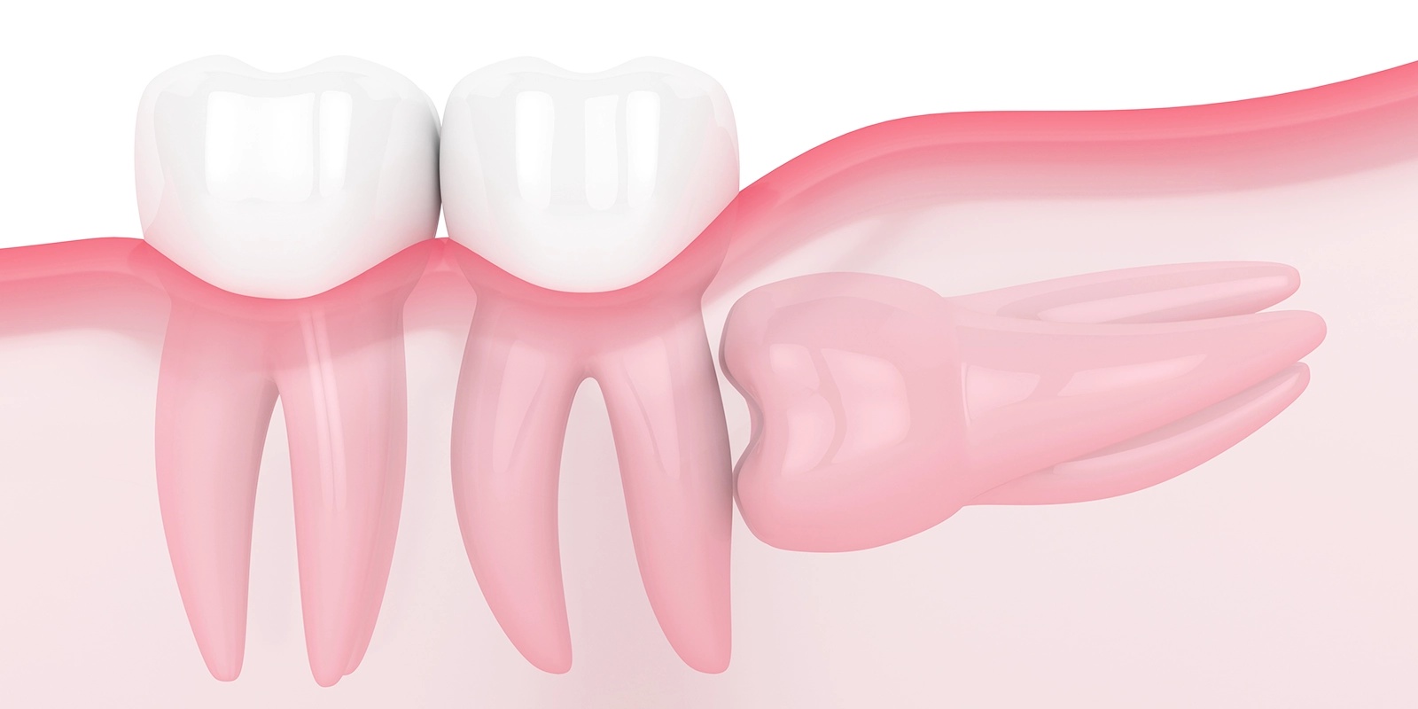 嚢胞（のうほう）の形成