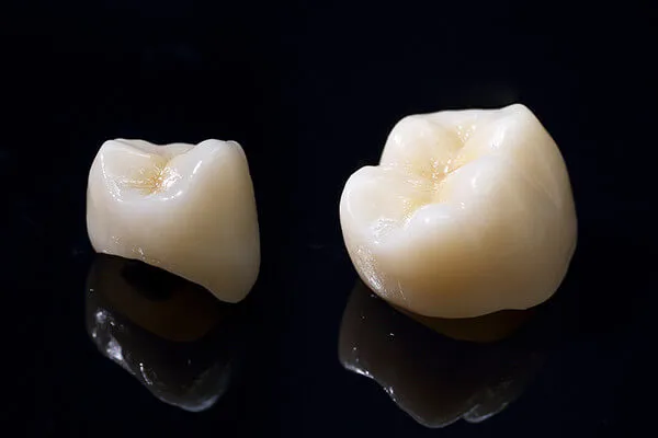 ジルコニアフルカウンター