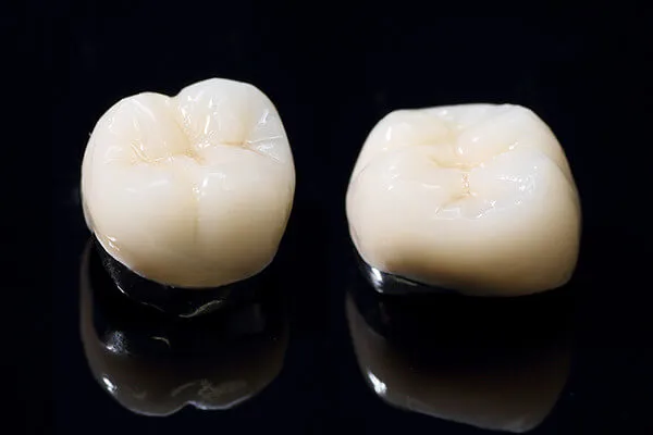 ハイブリッドセラミックス（奥歯）