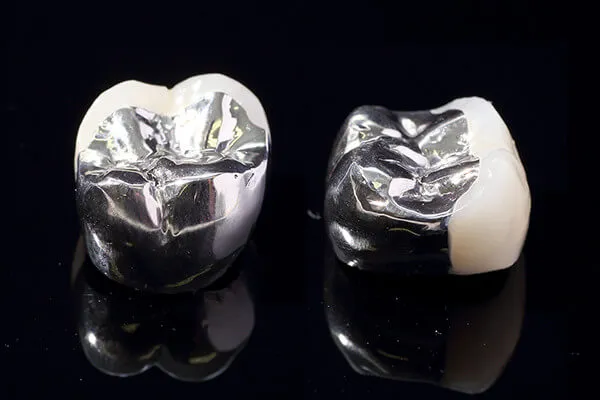 硬質レジン前装冠（奥歯）