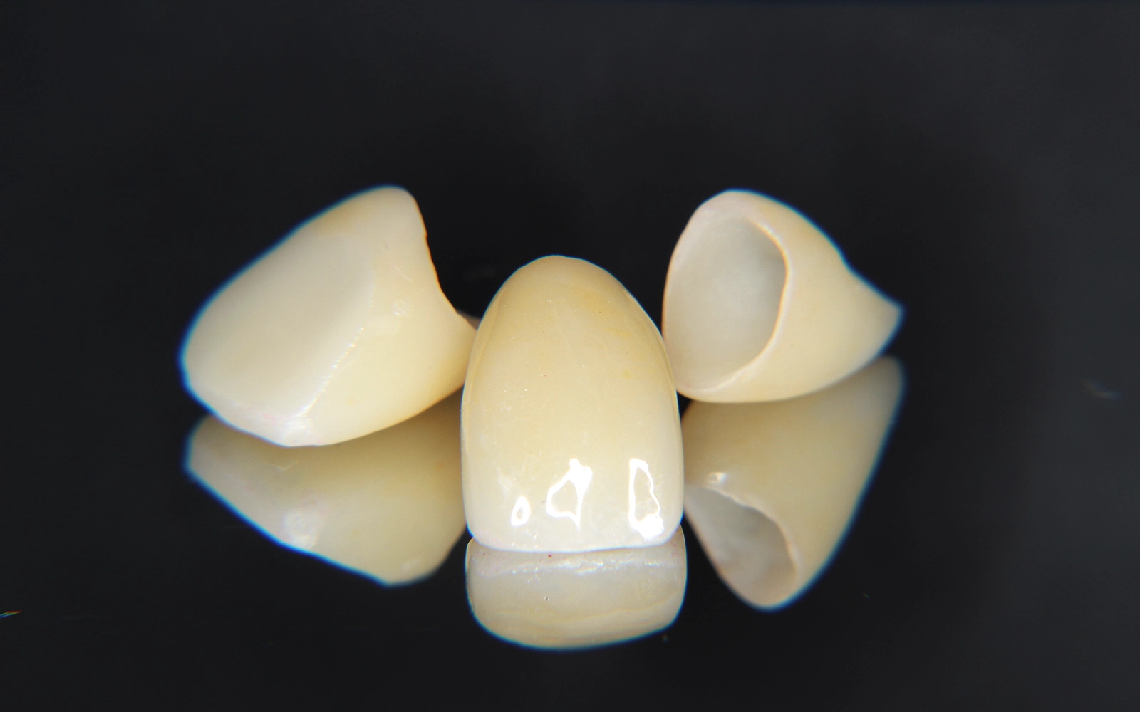 審美性：天然歯と見分けがつかないレベルの再現