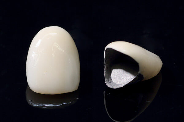 ハイブリッドセラミックス