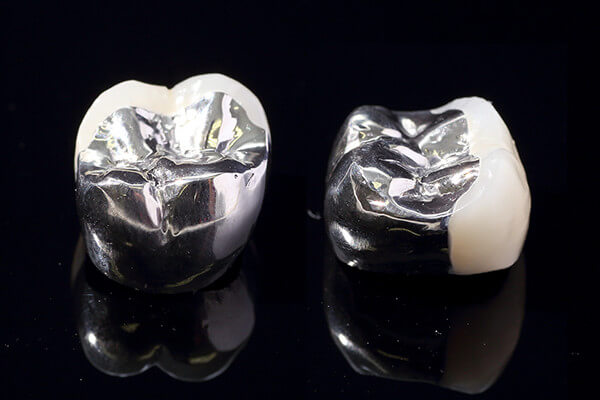 硬質レジン前装冠