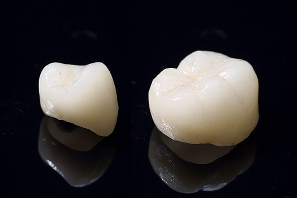 ジルコニアセラミクス