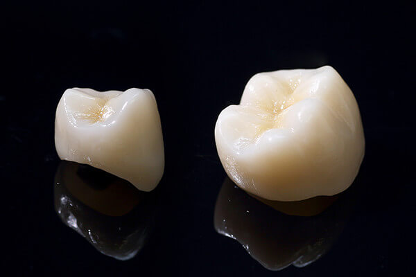 ジルコニアフルカウンター