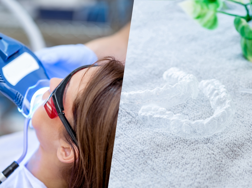 デュアルホワイトニング