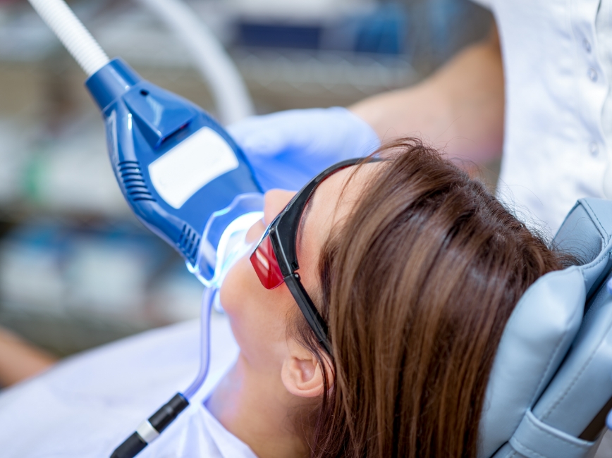 オフィスホワイトニング（リップリー込み）