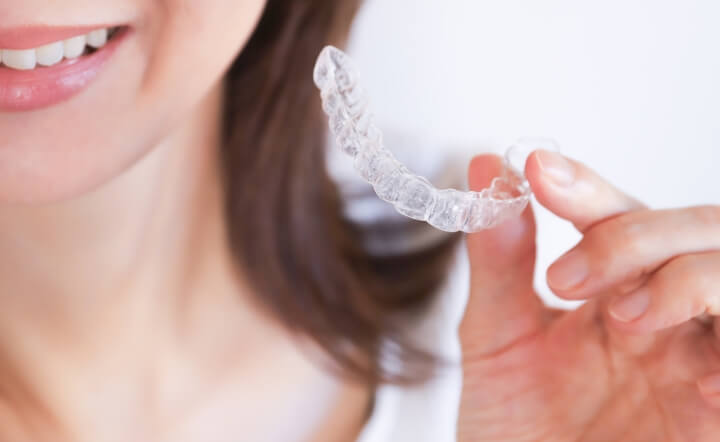 マウスピース型矯正（アライナー矯正）