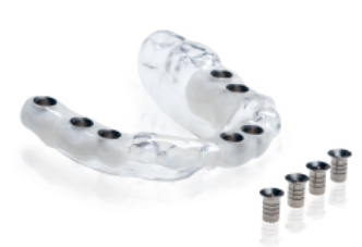 リスクを抑えたインプラント治療