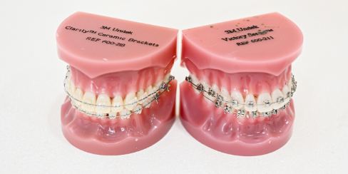 ブラケット矯正