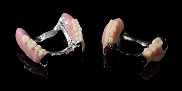 チタン義歯部分入れ歯